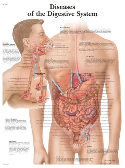 All Products - Diseases Of The Digestive System